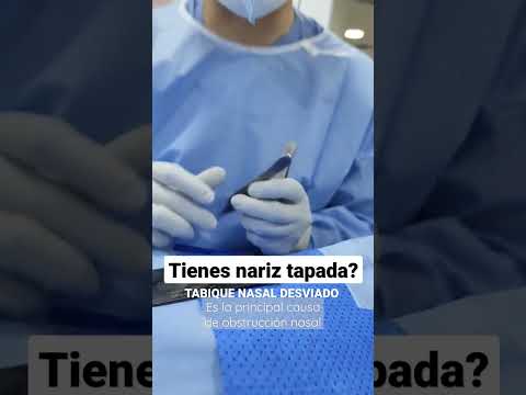 Video: ¿Qué tan común es la perforación del tabique?