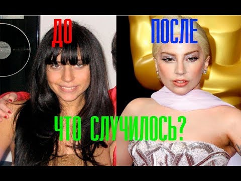 Леди Гага  до и после.  После пластики и без макияжа!