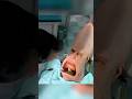 Alien Visits Earth Dentist 5 Rows Of Teeth What Happens When It Has A Baby Moviereview Shorts