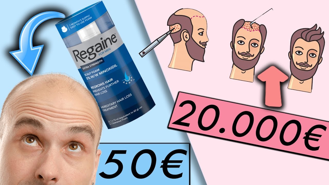 Haarausfall STOPPEN Mit Diesen TOP 10 Behandlungen Kosten Und 
