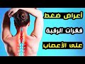أعراض ضغط فقرات الرقبة على الأعصاب