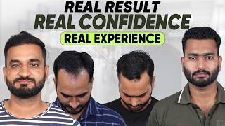 Hair Transplant in India (HX-KMHY) | Best Results & Cost of Hair Transplant in India