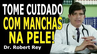 Dr. Rey -  Tome cuidado com manchas na pele!