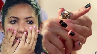 Horrible Work Injury | Just For Laughs Gags