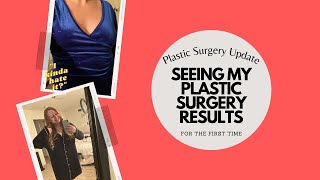 Seeing my Plastic Surgery Results for the FIRST TIME! | Plastic Surgery Update