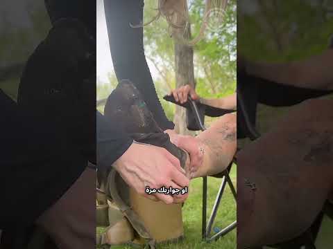 شاهد ما يحدث للأقدام بعد ركض أطول ماراثون في العالم 100 ميل Shorts 