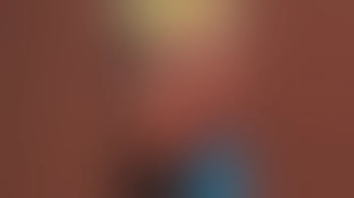 #pimplepopper #blackheads #cystremoval #drkhaledsadek Dr Khaled Sadek Lipomacyst.com