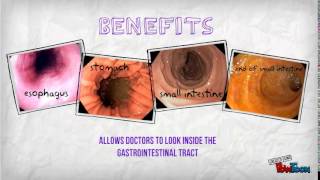 Upper Endoscopy 101