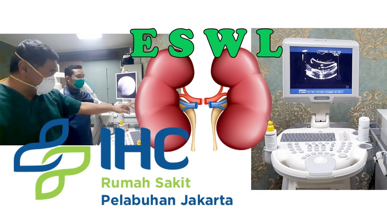 CARA PRAKTIS MENGHILANGKAN BATU GINJAL DENGAN ESWL