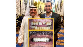 ازاي ف ي ٤ ايام حولنا اسنان الراجل السعودي الجميل ده من الشكل ده للشكل ده ؟