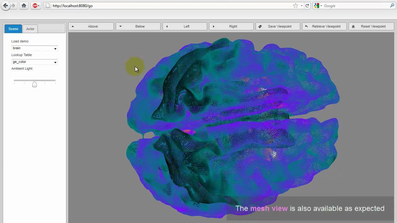 mapping the mouse brain - youtube Images High Quality... Voxelent - Pervasive Medical Imaging Platform - YouTube