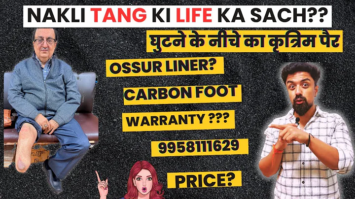 😱Below Knee Prosthesis || Artificial Leg with Liner || Ossur Leg || Artificial Leg with Carbon Foot
