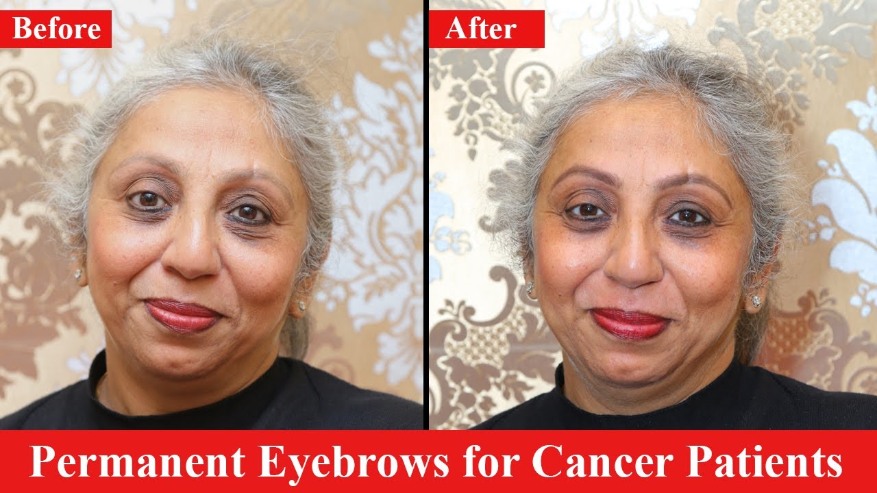 Permanent Eyebrows for Cancer Champions by Bharti Taneja's Alps Beauty