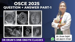OSCE 2025 Q &amp; A Part-1 | DNB Theory Class | DNB OBGYN coaching All India chapter | OBGYN Live Class