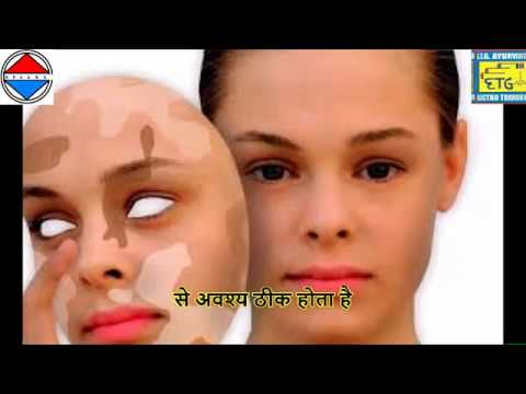 Dr D. B. Bajpai Broadcaster Channel : LIVE STREAMING 21 MARCH 2019