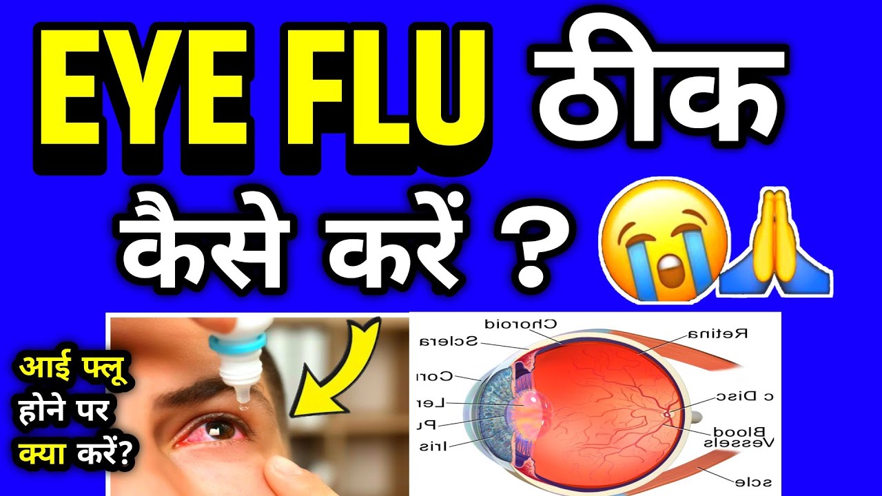 Eye flu hone par kya karen eye flu kaise thik kare jaldi