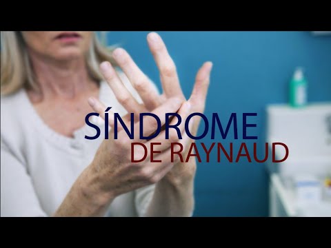 Vídeo: Enfermedad De Raynaud (síndrome): Causas, Síntomas Y Tratamiento