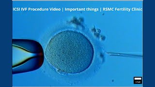 ICSI IVF Procedure Video | Important things | RSMC Fertility Clinic