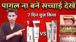 Yayashi Sp 4 Toothpaste Review.Yayashi Sp 4 Toothpaste 2026.Patanjali Dant Kranti Tootphaste