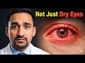 आँखों में जलन और पानी? Dry Eye Treatment at Home | Symptoms, Cause &amp; Cure