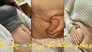 very special trending viral shorts video/ funny video animals 2023 Fun Main Dam