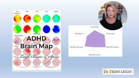 What Does the ADHD Brain Map Look Like?