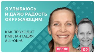 Все этапы имплантации all-on-6 👉 отзыв и ощущения реального пациента