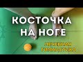 КАК остановить рост КОСТОЧКИ на ноге. Делайте ЭТИ упражнения