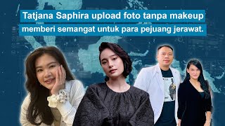 Tatjana Saphira upload foto tanpa makeup,  memberi semangat untuk para pejuang jerawat.