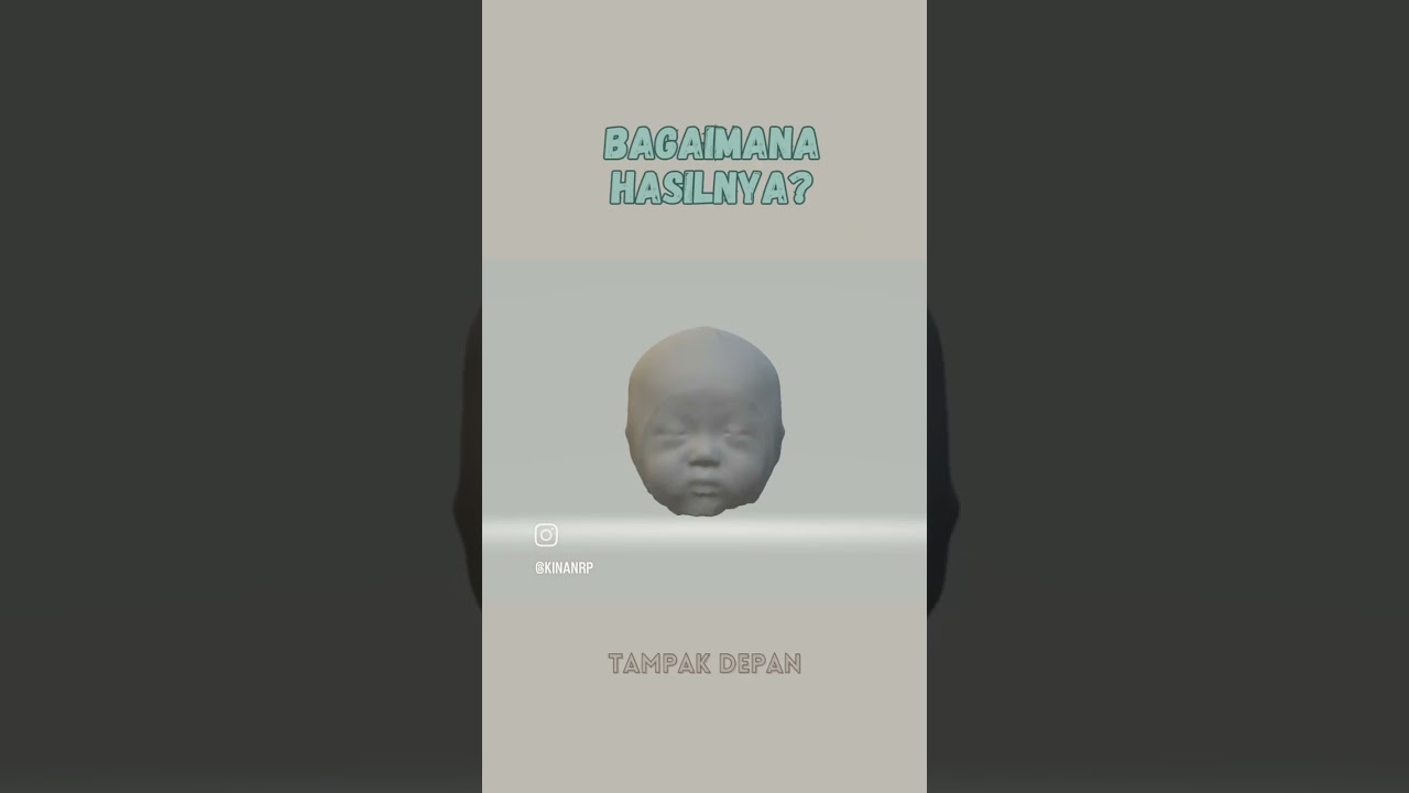 Pemakaian Bantal Mimos Sejak Lahir Cegah Peyang #kepalapeyang #kepalapeyangindonesia