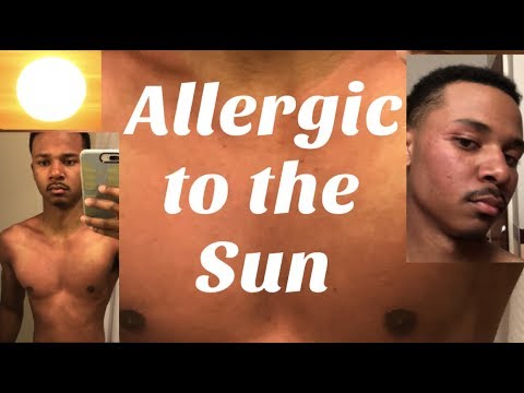 Video: Sun Rash: Förgiftning, Allergi, Behandling, Orsaker, Bilder Och Mer