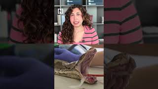‘World-first’ cancer treatment saves python after tumour destroys jaw