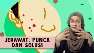 Download Lagu Jerawat: Punca dan Solusi MP3
