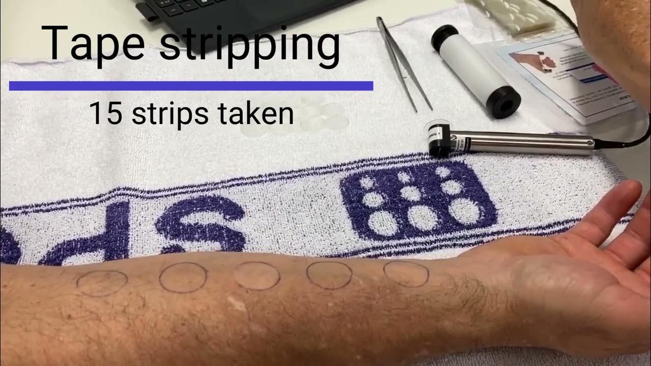 Tape stripping YouTube