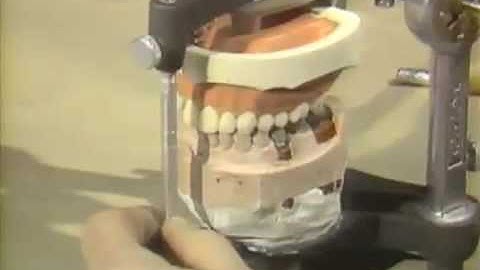 Preliminary and Final Finishing of the Bridge