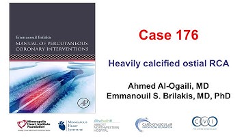 Case 176: Manual of PCI - Heavily calcified ostial RCA