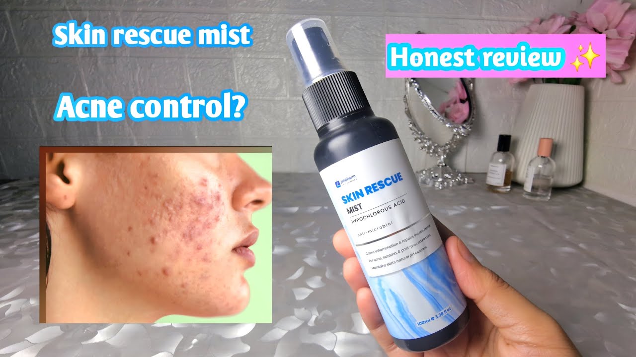 Jenpharm skin rescue mist | control acne and repair skin barrier | Glow with Fatima 