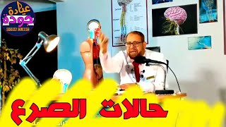 حالات الصرع epilepsy {الأعصاب}(10) دكتور جودة محمد عواد