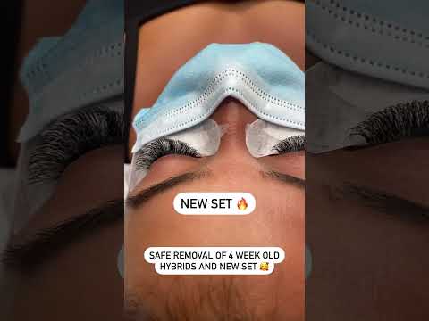 Removal of 4