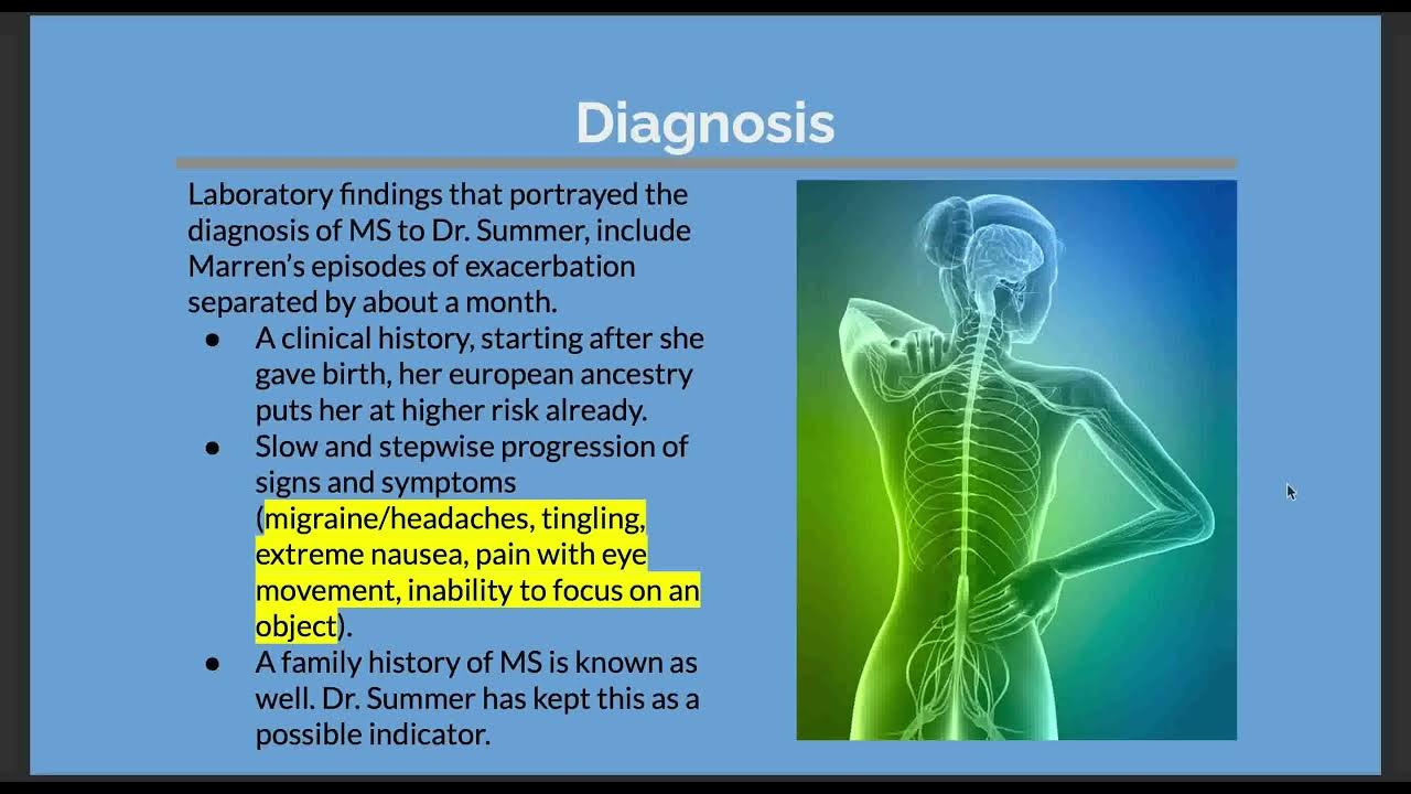 multiple sclerosis case study