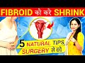 Fibroid   shrink naturally without surgery         