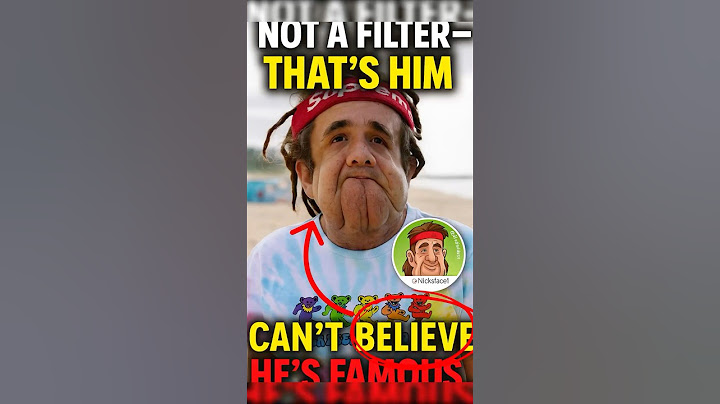 The TikTok Star with the Most Unique Face 😲 | His Story Will Shock You