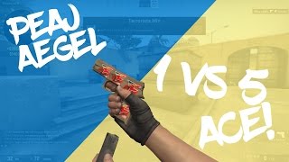 PEAJ.AEGEL 1v5 Ace! Resimi