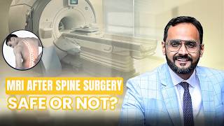 Is It Safe to Get an MRI After Spine Surgery? | What Patients Must Know #SpineSurgery #MRI