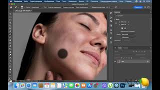 Removing pimples from the face by photoshop