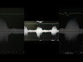 DCRV with RVOT Repair