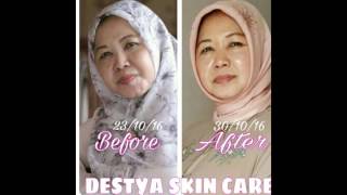 Destya Skin Care Produk Terbaik