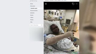 Hamilton County deputy hurt in hit-and-run moved out of ICU