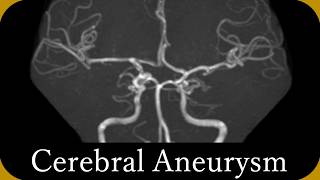 Imaging diagnosis of Cerebral aneurysm (CT/MRI) trial