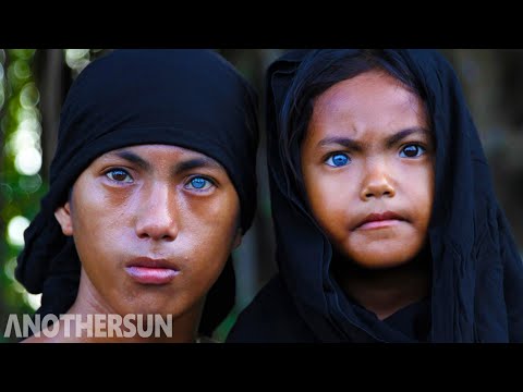 Video: Adakah heterochromia menjejaskan penglihatan?